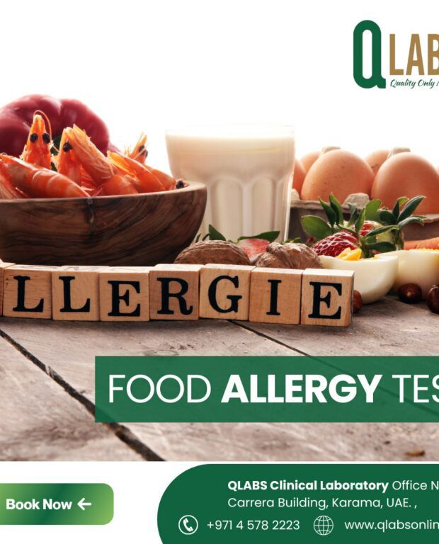 FOOD Allergy Test Karama Dubai - Qlabs
